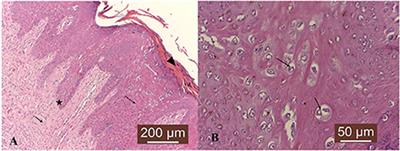 Expression of matrix metalloproteinases (MMPs)−2/-7/-9/-14 and tissue inhibitors of MMPs (TIMPs)−1/-2 in bovine cutaneous fibropapillomas associated with BPV-2 infection